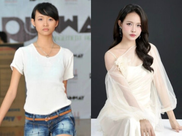 Trương Mỹ Nhân gái xinh thay đổi cuộc sống nhờ "dao kéo"