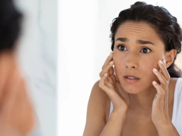 Dấu hiệu nào trên da nhiều người gặp phải cảnh báo căn bệnh không thuốc chữa, nguy hiểm hơn cả ung thư da?