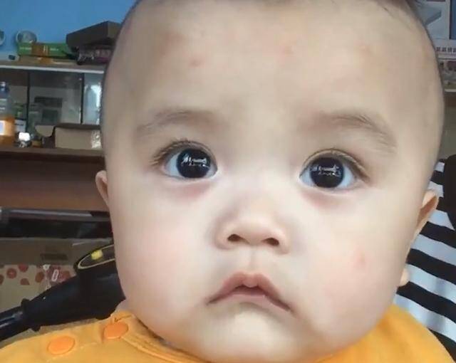Con trai 2 tuổi ngủ dậy trên đầu liền xuất hiện nhiều khối u bất thường, người mẹ tá hoả khi biết nguyên nhân - 4