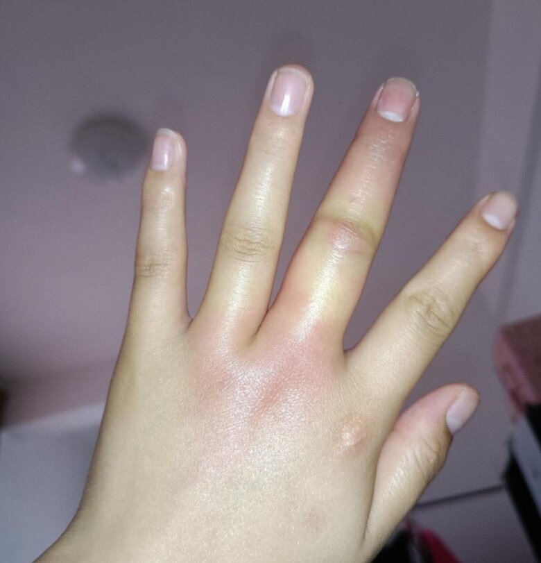 Gửi con về quê nghỉ hè với ông bà, ngày về đón mẹ tá hoả khi mặt đứa trẻ biến dạng - 2