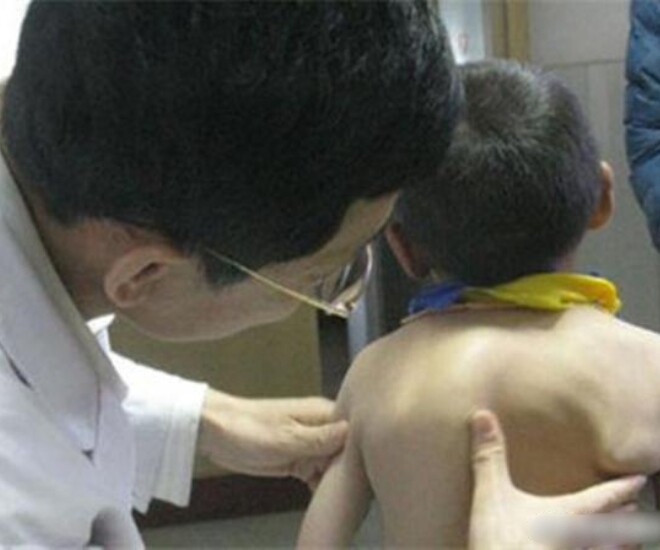 Mẹ phát hiện lưng con ngày càng biến dạng, biết nguyên nhân do thói quen của bà nội, người mẹ hối hận - 1