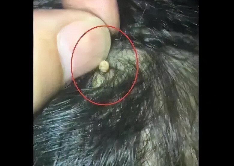Mẹ phát hiện trên đầu con xuất hiện một lỗ sâu kỳ lạ liền đưa đi khám, đến bệnh viện bác sĩ nói: “Đứa trẻ quá may mắn” - 2