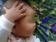 Yêu con - Con trai 1 tuổi liên tục gãi đầu, bố mẹ tưởng hành động bình thường cho đến khi phát hiện sự thật kinh hoàng