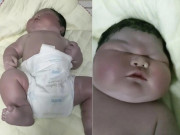 Bé sơ sinh chào đời da tím tái, nặng 13 kg, bác sĩ đỡ đẻ nhìn thấy liền thốt lên: Không thể tin nổi