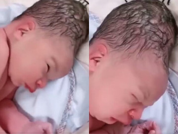 Bé sơ sinh chào đời có hình dáng đầu kỳ lạ, gia đình vừa nhìn thấy đứa trẻ đã sợ không dám bế
