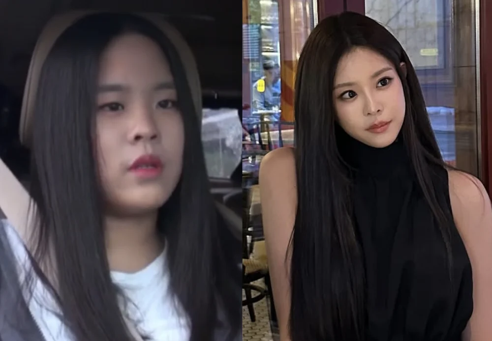 Woo Seo Yoon ở show truyền hình thời niên thiếu (trái) và hiện tại.