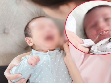 Bé 12 tháng tuổi tím tái khi bú, bác sĩ lưu ý thói quen gây hại