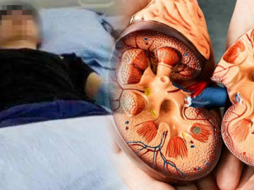 Uống loại nước này suốt 1 năm, du học sinh Nhật Bản bàng hoàng mắc suy thận