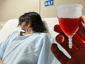 Cô gái 30 tuổi nhiễm trùng thận vì thứ 'đồ nữ giới' quen thuộc dùng hàng tháng