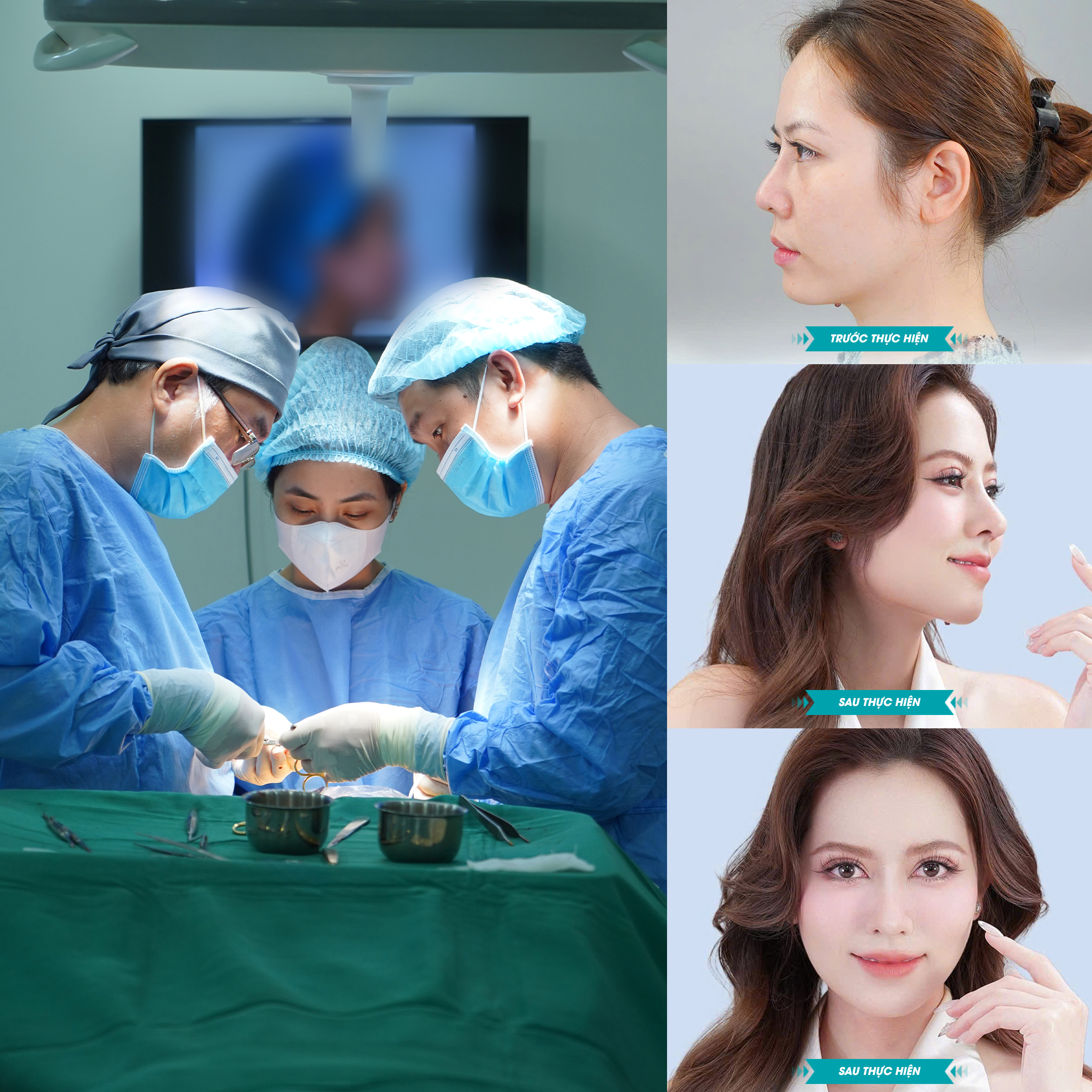 Các bạn trẻ được trải nghiệm làm đẹp dáng mũi an toàn theo quy chuẩn bệnh viện