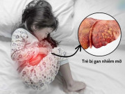 Sức khỏe - Bé gái 8 tuổi mắc gan nhiễm mỡ, bác sĩ chỉ ra sai lầm trong bữa ăn khiến nhiều phụ huynh chủ quan