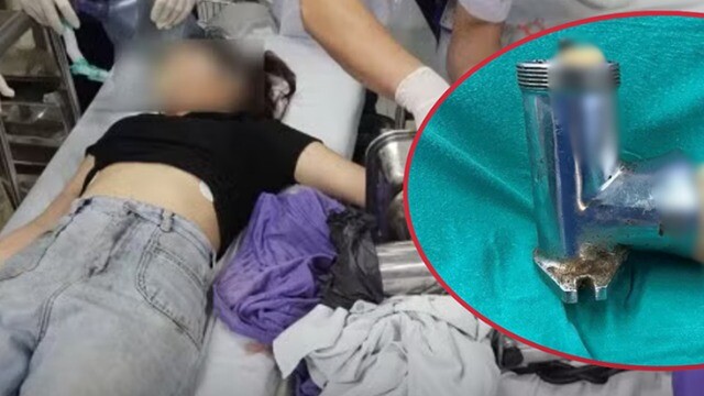 Cô gái 19 tuổi bị máy xay thịt cuốn nát bàn tay, bác sĩ buộc phải cắt bỏ chi