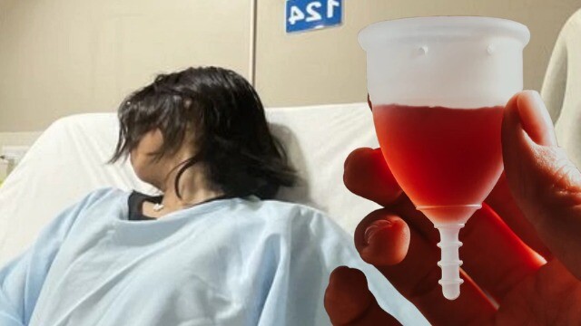 Cô gái 30 tuổi nhiễm trùng thận vì thứ 'đồ nữ giới' quen thuộc dùng hàng tháng