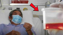 Phát hiện ung thư bàng quang đa ổ từ dấu hiệu tiểu ra máu