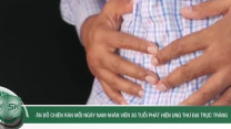 Ăn đồ chiên rán mỗi ngày, nam nhân viên 30 tuổi phát hiện ung thư đại trực tràng