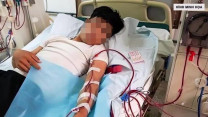 Suy thận ở tuổi 35 vì thói quen xấu nhiều người mắc khi dùng nước chấm