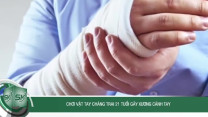 Chơi vật tay, chàng trai 21 tuổi gãy xương cánh tay