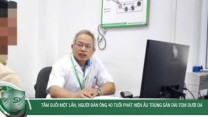 Tắm suối một lần, người đàn ông 40 tuổi phát hiện ấu trùng sán dài 7cm