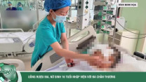 Uống rượu bia rồi lái xe điện, nữ sinh nhập viện với đa chấn thương