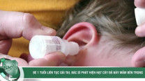Bé trai liên tục gãi tai, bác sĩ phát hiện hạt cây đã nảy mầm bên trong
