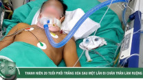 Thanh niên 20 tuổi phổi trắng xóa sau một lần đi chân trần làm ruộng
