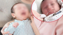 Bé 12 tháng tuổi tím tái khi bú, bác sĩ lưu ý thói quen gây hại