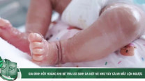 Gia đình hốt hoảng khi bé trai sơ sinh da nứt nẻ như vảy cá