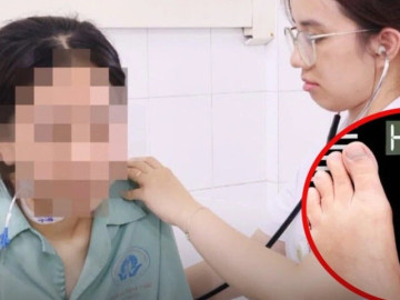 Thiếu nữ 17 tuổi mắc bệnh người già sau nửa tháng khát nước, sụt 5 kg