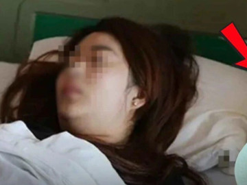 Cô gái 20 tuổi ung thư dạ dày vì uống nước theo cách này