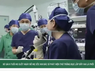 Bé gái 6 tuổi ho suốt ngày, bố mẹ sốc khi bác sĩ phát hiện thứ trắng đục lấp đầy hai lá phổi