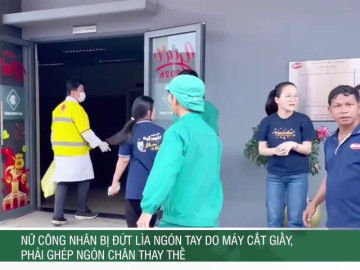 Nữ công nhân bị đứt lìa ngón tay do máy cắt giấy, phải ghép ngón chân thay thế