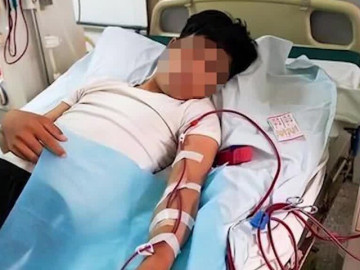 Suy thận ở tuổi 35 vì thói quen xấu nhiều người mắc khi dùng nước chấm