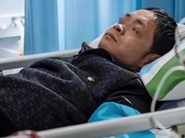 Ăn đậu đen mỗi ngày vì nghĩ ‘bổ thận’, người đàn ông 47 tuổi bàng hoàng nhận kết đắng