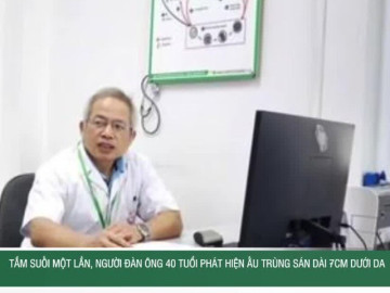 Tắm suối một lần, người đàn ông 40 tuổi phát hiện ấu trùng sán dài 7cm