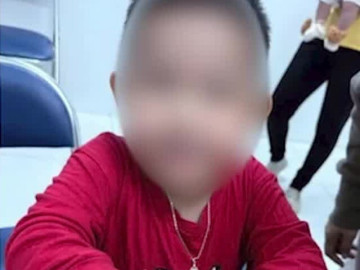 Ngáy to tưởng bình thường, bé trai 4 tuổi phát hiện mắc hội chứng nguy hiểm