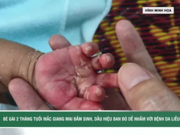 Tưởng bệnh da liễu, bé 2 tháng tuổi mắc giang mai
