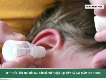 Bé trai liên tục gãi tai, bác sĩ phát hiện hạt cây đã nảy mầm bên trong