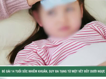 Bé gái 14 tuổi sốc nhiễm khuẩn, suy đa tạng từ một vết đốt dưới ngực