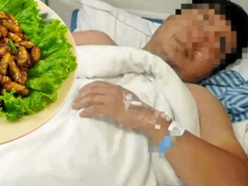 Người đàn ông 41 tuổi suýt chết sau khi ăn 20 con nhộng tằm