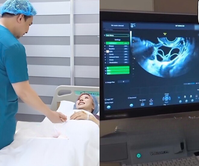 Sau thăm khám, bác sĩ cho biết chất lượng trứng của 8X khá tốt, cuối cùng cô trữ thành công 19 trứng.