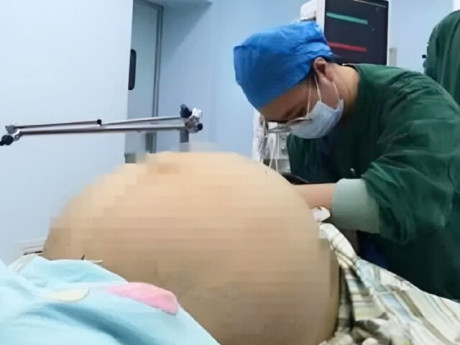 Thiếu nữ 2K2 bụng phình to như có bầu, mẹ lo lắng đưa đi khám, kết quả chụp CT tại bệnh viện gây ngỡ ngàng