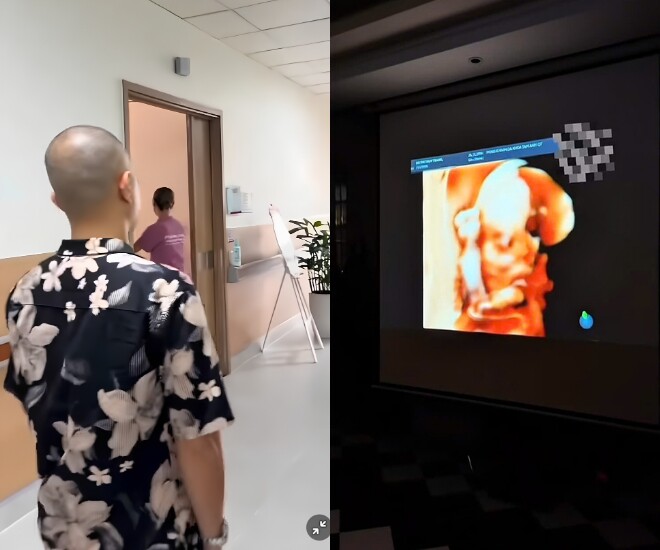 Người đẹp được chồng doanh nhân đồng hành đi khám thai, lần đầu nhìn rõ mặt con.
