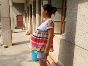 Bà bầu - Cơ thể bất ngờ mọc thêm “vật thể lạ” khi mang thai, người mẹ bối rối không dám mặc đồ hở
