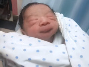 Bà bầu - Tiểu công chúa chào đời kèm 1 bào thai nữa dính chặt vào mông, bác sĩ cũng ngỡ ngàng: Cực hiếm gặp!