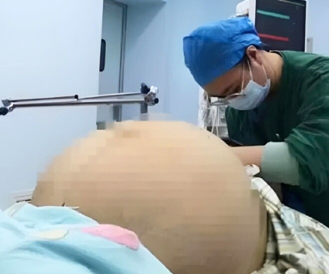 Khối u khổng lồ khiến bụng cô gái phình to như mang thai - Ảnh minh hoạ.