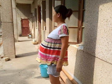 Bà bầu - Cơ thể bất ngờ mọc thêm “vật thể lạ” khi mang thai, người mẹ bối rối không dám mặc đồ hở