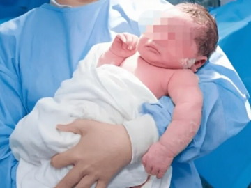 Bà bầu - Mẹ bầu mê ăn sầu riêng suốt thai kỳ, ngoại hình em bé khi chào đời khiến cả phòng sinh bất ngờ