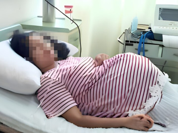 Bà bầu - Sản phụ vừa sinh đôi cặp long phụng, bác sĩ chuẩn bị khâu vết mổ thì ngỡ ngàng: Vẫn còn một em bé nữa!