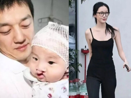 Con gái hở hàm ếch của Lý Á Bằng gây kinh ngạc vì dậy thì xinh khác hẳn lúc nhỏ, cao 1m75, dáng đẹp chuẩn người mẫu