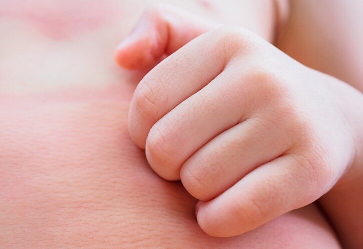 Tuyệt đối không chủ quan với những biểu hiện dị ứng của trẻ (nếu có) sau khi ăn. Ảnh minh họa. 